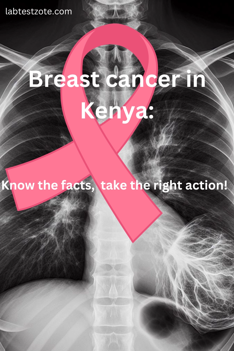 Breast Cacner in Kenya - Mammogram