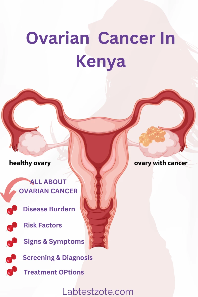 Ovarian Cancer In Kenya