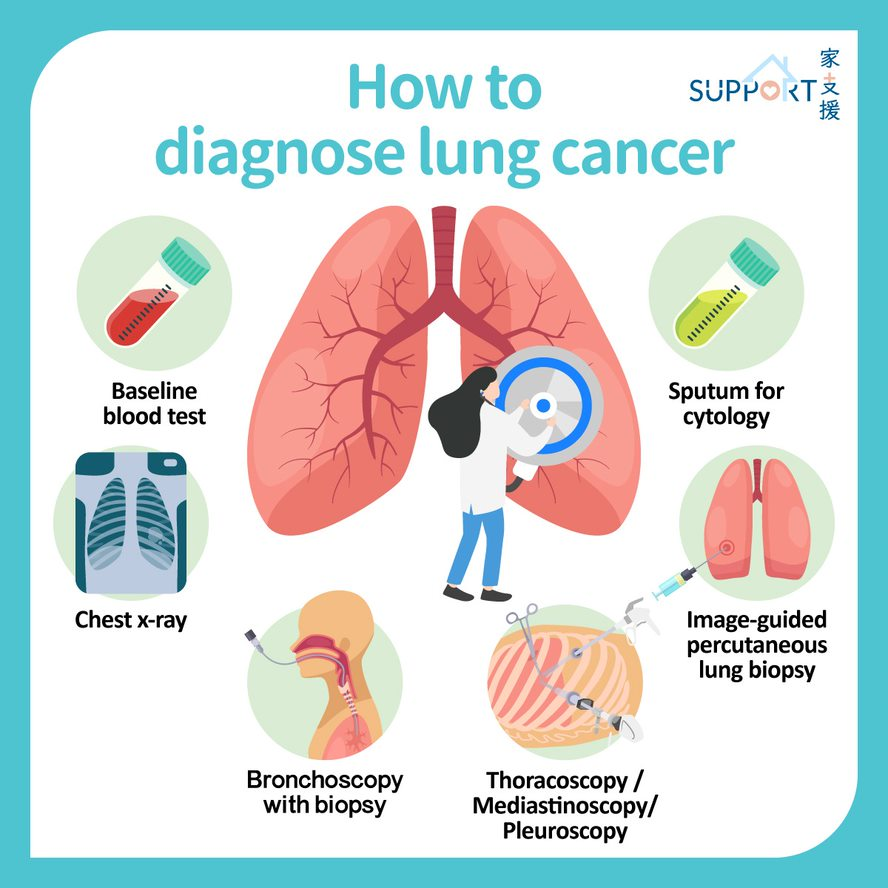 Lung Cancer- Diagnostic modalities